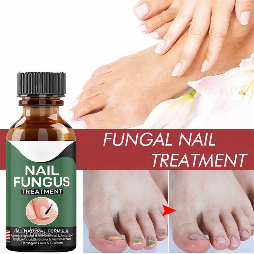 Fast Nail Fungal Repair Essences Serum Care Foot Nail Fungus Removal
