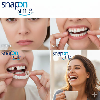 Instant Smile Reusable Snap On Veneers (Upper & Lower) Premium Quality